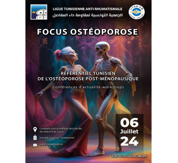 Focus Ostéoporose