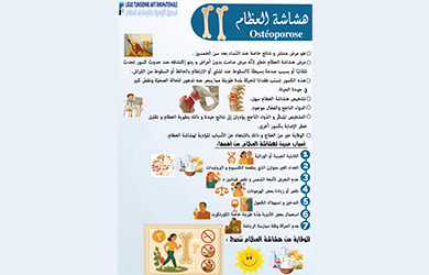 هشاشة العظام - Ostéoporose